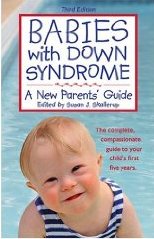 Babies with Down Syndrome